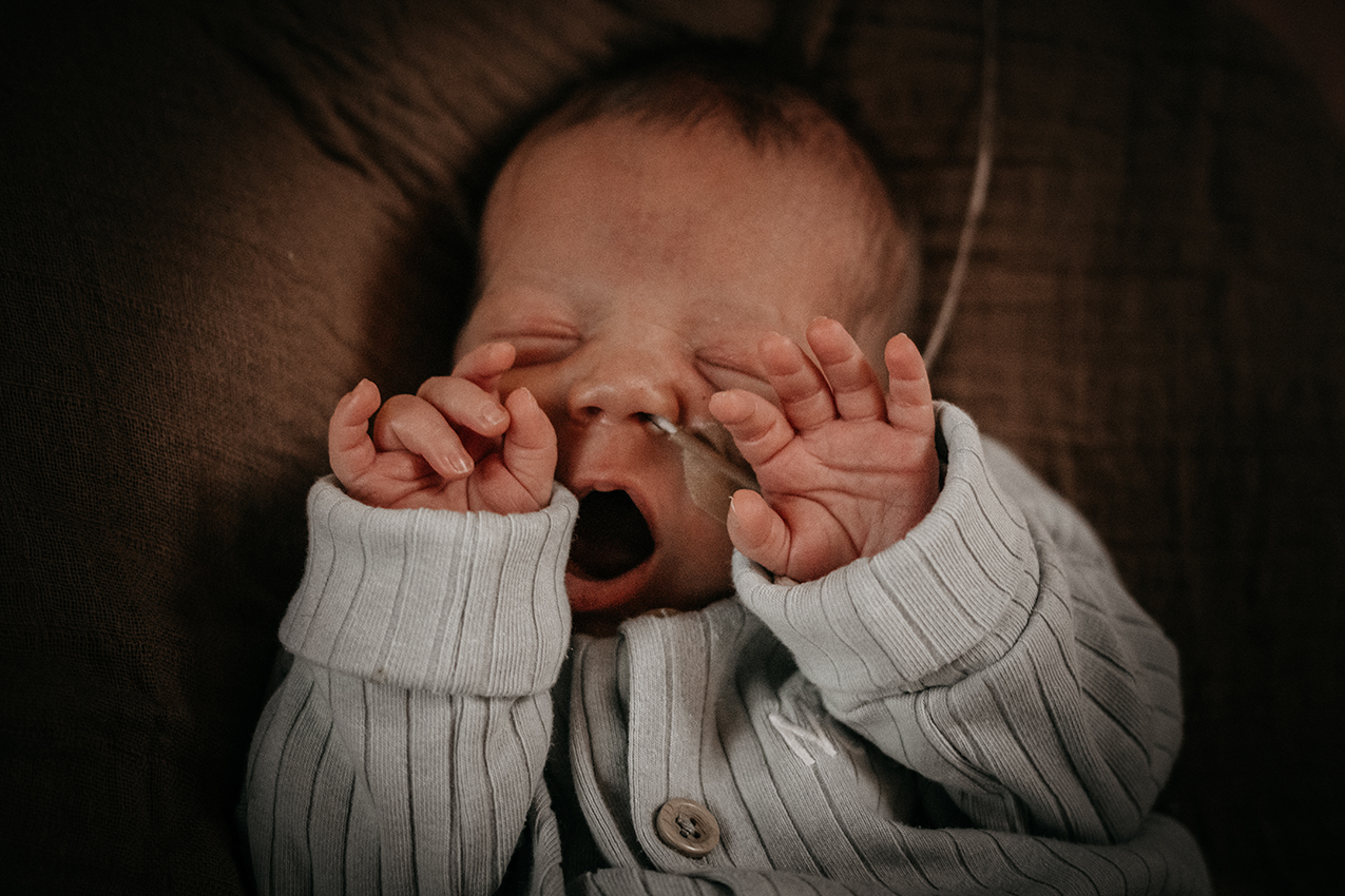 Foto van het gezichtje van een premature baby, newbornshoot